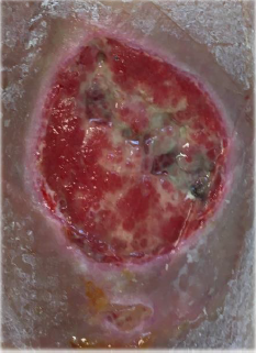 biomedres-openaccess-journal-bjstr