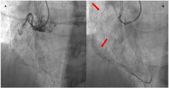 biomedres-openaccess-journal-bjstr