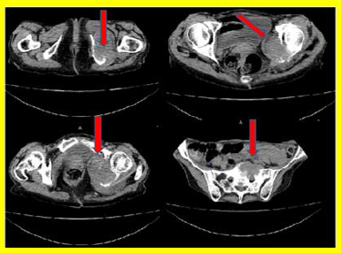 biomedres-openaccess-journal-bjstr
