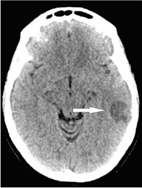 biomedres-openaccess-journal-bjstr