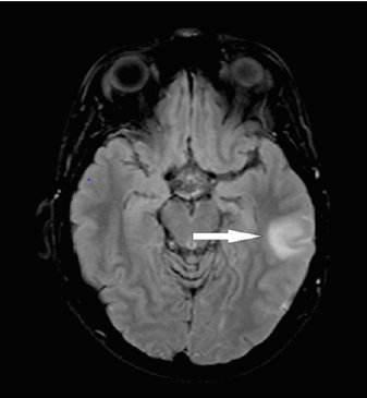 biomedres-openaccess-journal-bjstr