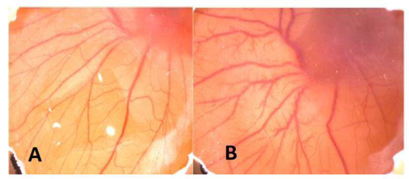 biomedres-openaccess-journal-bjstr