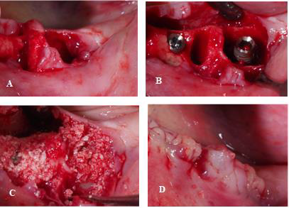 biomedres-openaccess-journal-bjstr