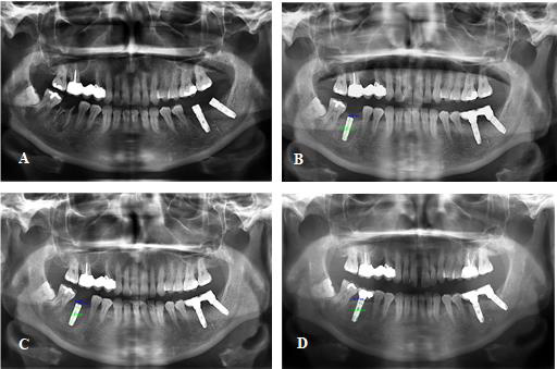 biomedres-openaccess-journal-bjstr