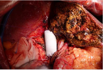 biomedres-openaccess-journal-bjstr