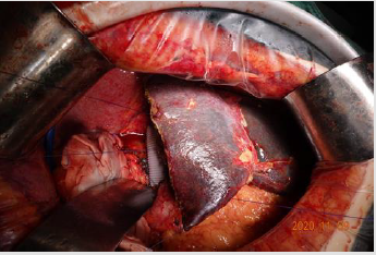 biomedres-openaccess-journal-bjstr