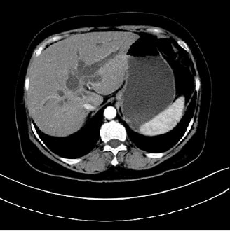 biomedres-openaccess-journal-bjstr