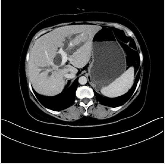 biomedres-openaccess-journal-bjstr
