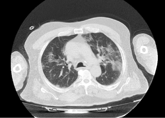 biomedres-openaccess-journal-bjstr