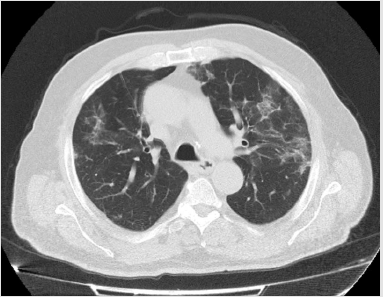 biomedres-openaccess-journal-bjstr