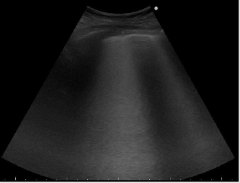 biomedres-openaccess-journal-bjstr