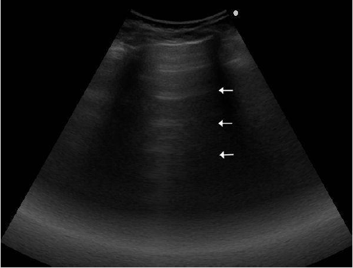biomedres-openaccess-journal-bjstr