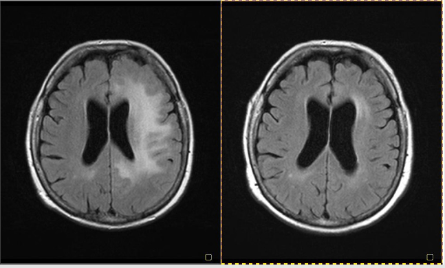 biomedres-openaccess-journal-bjstr