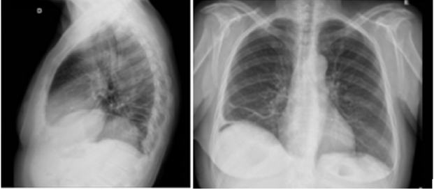 biomedres-openaccess-journal-bjstr