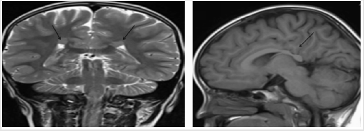 biomedres-openaccess-journal-bjstr