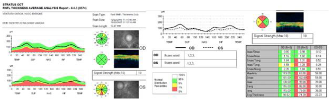 biomedres-openaccess-journal-bjstr