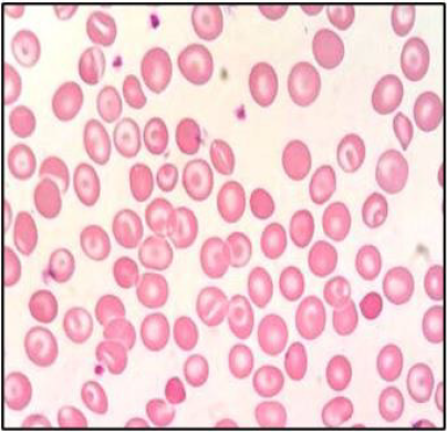 biomedres-openaccess-journal-bjstr