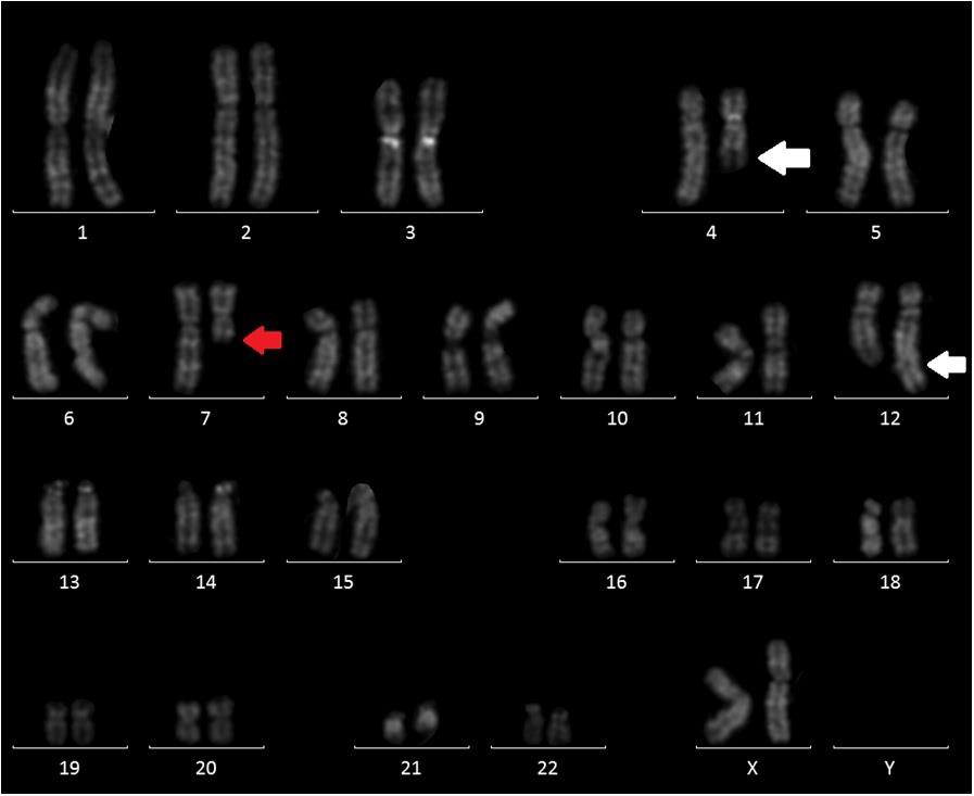 biomedres-openaccess-journal-bjstr