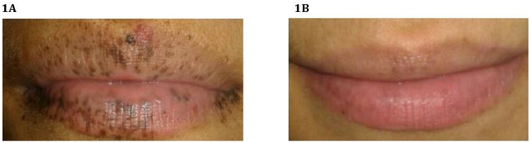 biomedres-openaccess-journal-bjstr