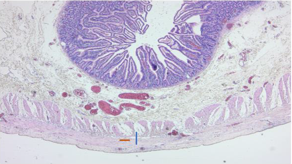 biomedres-openaccess-journal-bjstr
