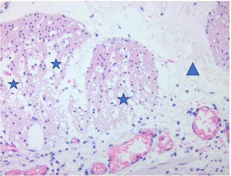 biomedres-openaccess-journal-bjstr