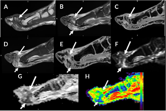 biomedres-openaccess-journal-bjstr
