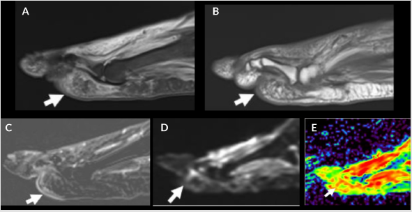 biomedres-openaccess-journal-bjstr