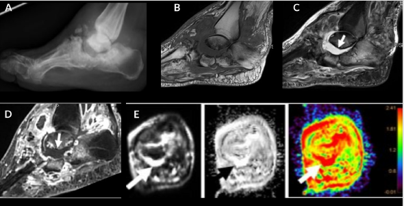 biomedres-openaccess-journal-bjstr