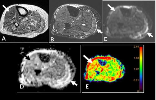 biomedres-openaccess-journal-bjstr