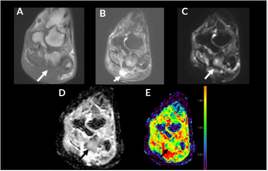 biomedres-openaccess-journal-bjstr