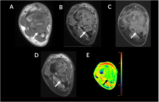 biomedres-openaccess-journal-bjstr