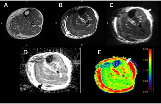 biomedres-openaccess-journal-bjstr