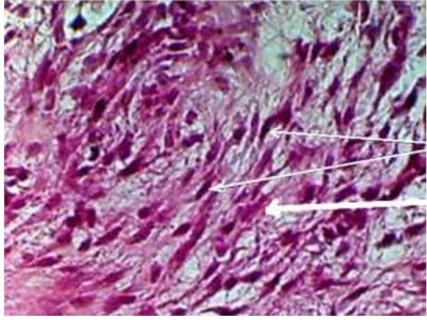 biomedres-openaccess-journal-bjstr