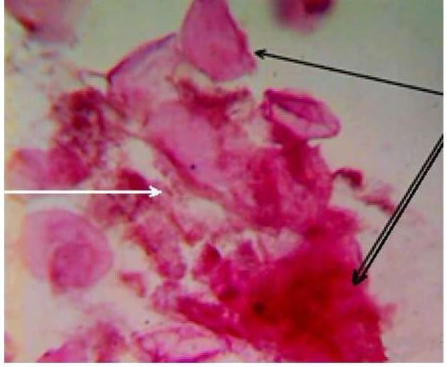 biomedres-openaccess-journal-bjstr