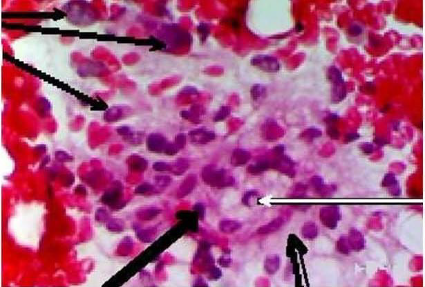biomedres-openaccess-journal-bjstr