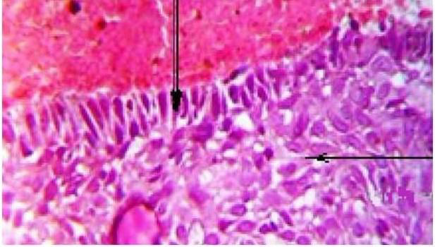 biomedres-openaccess-journal-bjstr