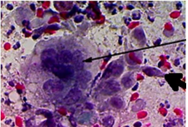 biomedres-openaccess-journal-bjstr