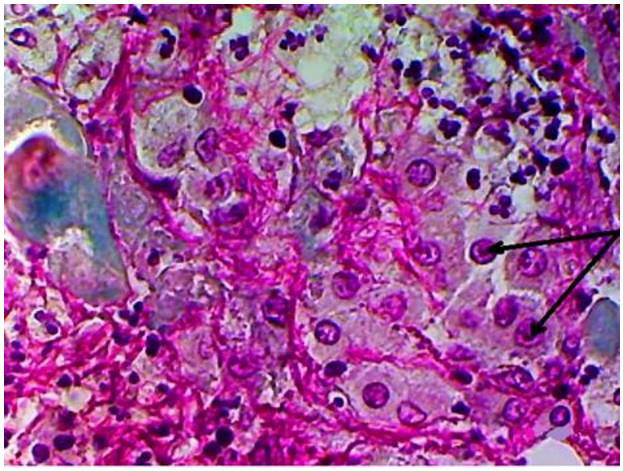 biomedres-openaccess-journal-bjstr
