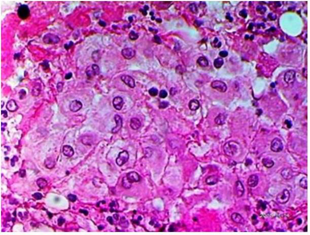 biomedres-openaccess-journal-bjstr