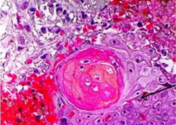 biomedres-openaccess-journal-bjstr