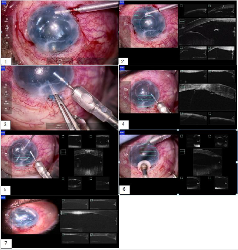 biomedres-openaccess-journal-bjstr