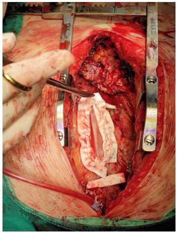 biomedres-openaccess-journal-bjstr
