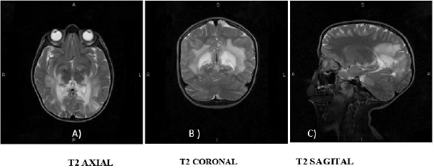 biomedres-openaccess-journal-bjstr
