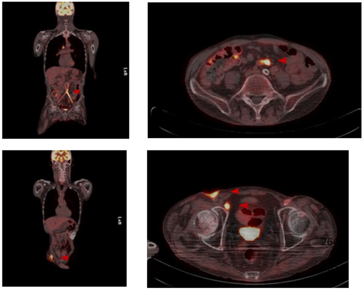 biomedres-openaccess-journal-bjstr
