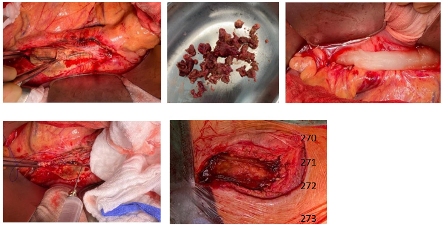 biomedres-openaccess-journal-bjstr