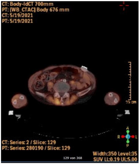 biomedres-openaccess-journal-bjstr