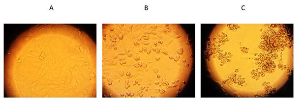 biomedres-openaccess-journal-bjstr