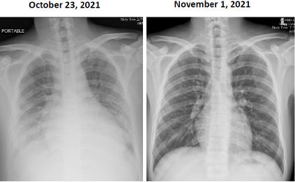 biomedres-openaccess-journal-bjstr