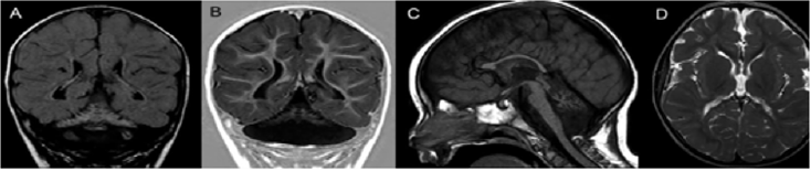 biomedres-openaccess-journal-bjstr