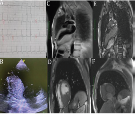 biomedres-openaccess-journal-bjstr